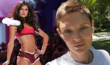 Xərçənglə mübarizə aparan model 