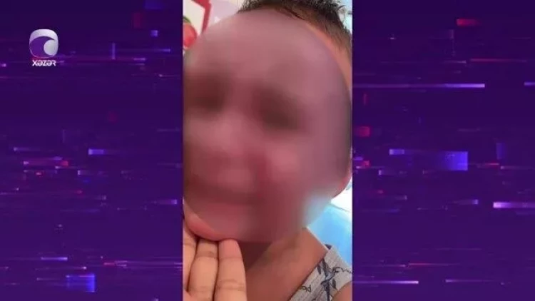 Bakıda bağçada uşaq xəsarət alıb, təcili yardım çağırılmayıb - VİDEO