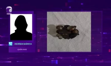 Batareya və maqnit qırıntıları udan 10 yaşlı uşağın anası DANIŞDI - VİDEO