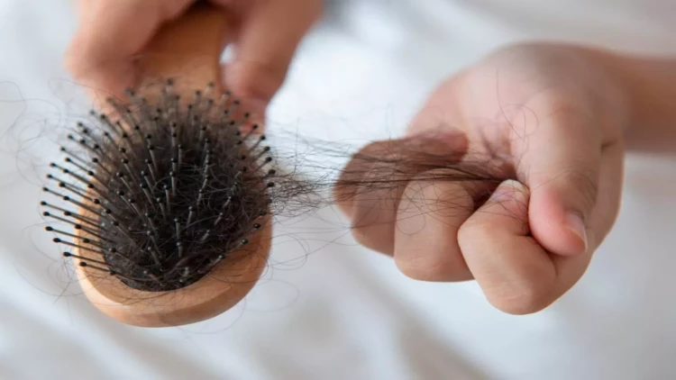 Çoxlu şirniyyat yemək saçları tökürmüş - Araşdırma