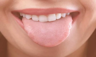 Dilin rənginə baxıb xəstəliyi 