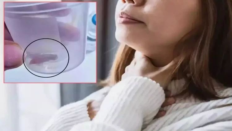 1,5 il davam edən öskürəyin səbəbi balqabaq tumu imiş