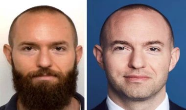 Avropanın ən çox axtarılan casusu bu ölkədə tapıldı - Əməliyyatla üzünü dəyişdirib.... - FOTO