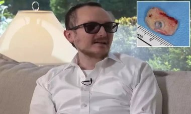 Ağzındakı diş hesabına 20 il sonra korluqdan xilas oldu - Tibb tarixində inqilab