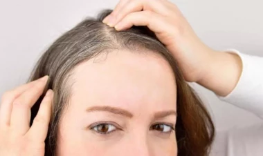 Ev üsulu ilə saçdakı ağ tellərə qarşı 