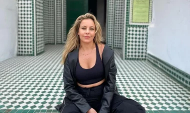 Aktrisanın serialdakı dəyişən görünüşünün səbəbi açıqlandı - FOTO