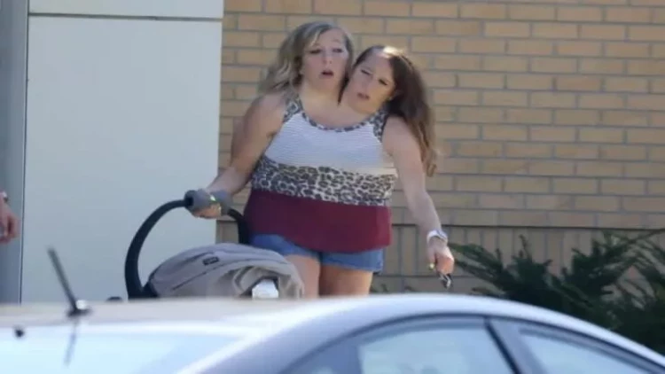 Məşhur siam əkizlərinin övladı oldu - FOTO