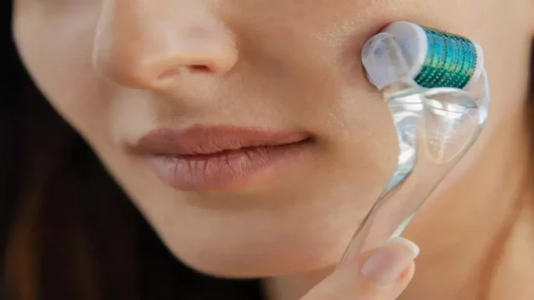 Saç əkdirməyə ehtiyac yoxdur - 3 aya tük çıxardır