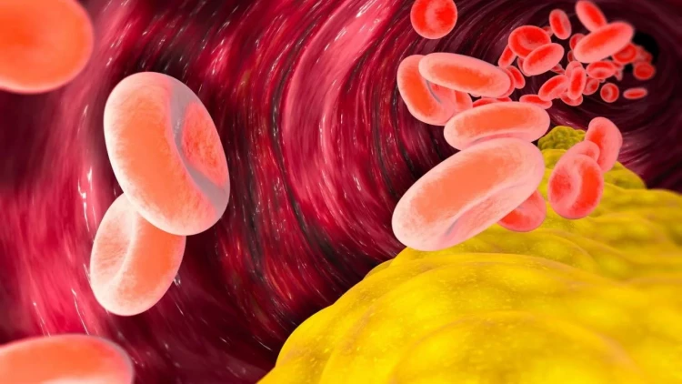 Adi ədviyyat xolesterini azaldır və ürək sağlamlığını dəstəkləyir