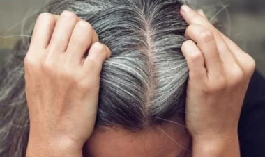 Ağ saçları 15 günə öz rənginə qaytarır - Kimyəvi boyalara son