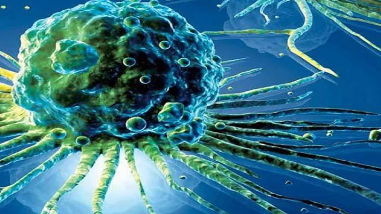 Mədə Xərçənginin əsas səbəbi tapıldı