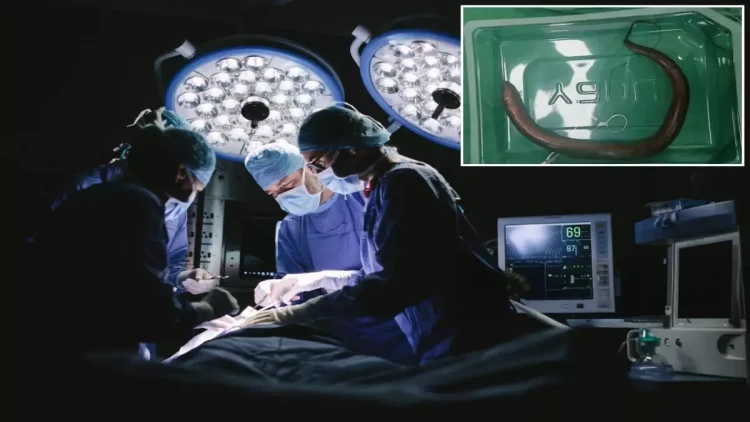 Qarnından canlı ilan balığı çıxdı - FOTO