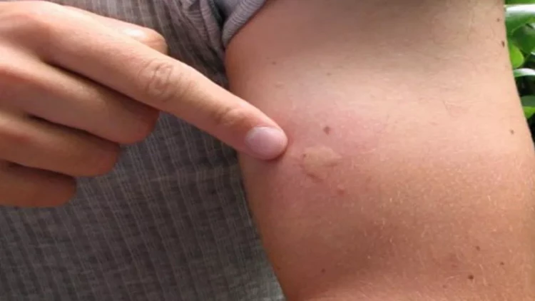 Yayda görünməz təhlükədən necə qorunaq?