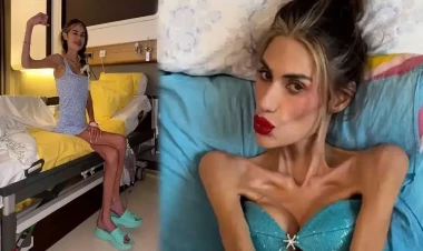 Çəkisi 23 kiloqrama düşən məşhurdan xəbər var