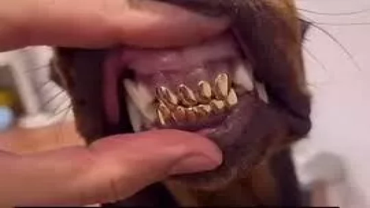 İtinə qızıldan dişlər düzətdirdi - VİDEO