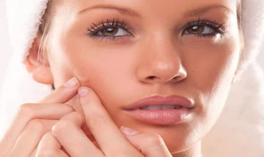 Bu qidalar üzdə sızanaq yaradır – Dermatoloqlardan xəbərdarlıq