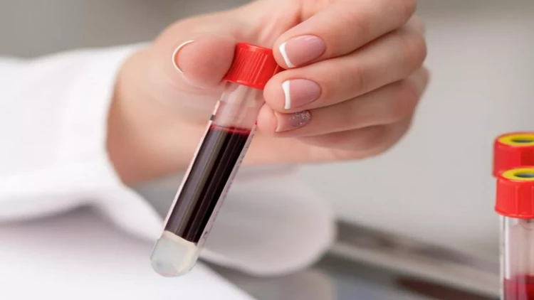 Alimlər süni qan qrupu yaratdı