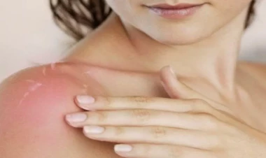 Xanımların DİQQƏTİNƏ: Keçən ilin günəş kremi bu gün sizi qorumaya bilər