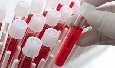 Ən ağıllı insanlar bu qan qrupundan olurlar