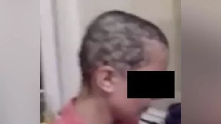 Azərbaycanda sevgilisinin saçını qırxan kişi həbs edildi