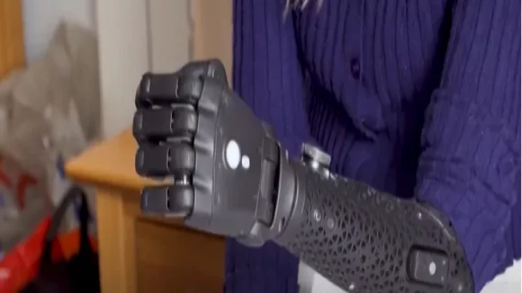 19 yaşlı “Instagram” fenomeni protez qolu ilə qeyri-adi bacarıqlar nümayiş etdirir