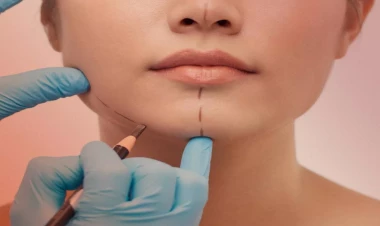 Adı siyahıda olmayan plastik cərrahlarla bağlı RƏSMİ AÇIQLAMA