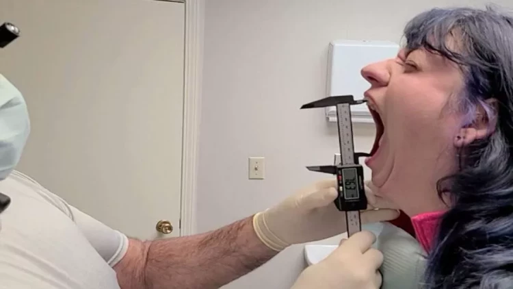 Dünyada ən yekə ağızlı QADIN