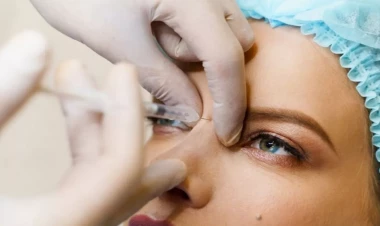 Botoksun gözlənilməz yan təsiri