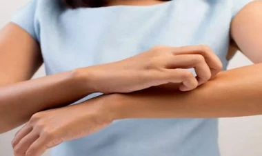 Qaşınmanın səbəbi bu imiş - Alimlər araşdırıb tapdı