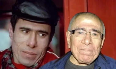 Bir zamanların sevilən aktyoru üz iflici keçirdi - son vəziyyəti - FOTO