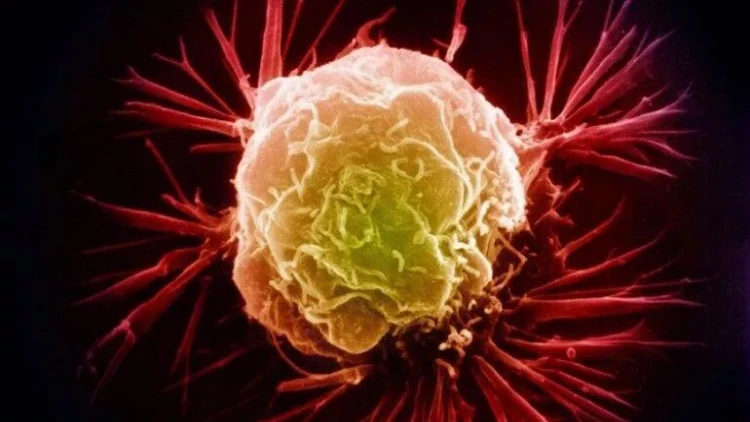 Bizi hər gün öldürən maddələr: xərçəng yaradır