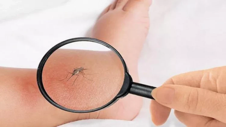 Bu ölkədə ağcaqanad öldürənlərə pul verilir - FOTO