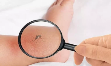 Bu ölkədə ağcaqanad öldürənlərə pul verilir - FOTO