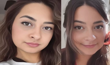 32 yaşlı tibb bacısı 