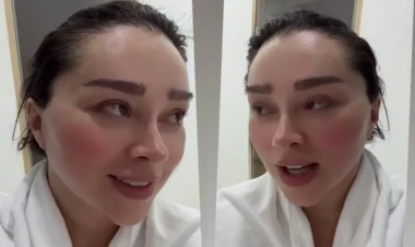 Xatirə İslamın başına iş gəldi - gözlərinə nə olub? - VİDEO