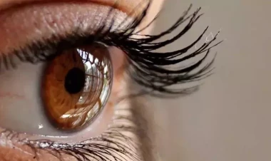 Kirpiklərdə üzə çıxan xərçəng əlaməti – Bu baş verirsə…