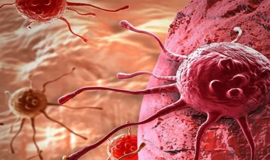 Xərçəngdən qoruyan yeni üsul açıqlandı