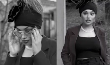 Bu da əməliyyatdan sonra 180 dərəcə dəyişən Türkan - FOTOlar