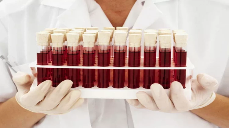 Kimlər qan verə bilməz?