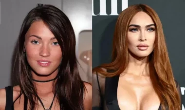 15 il ərzində plastik əməliyyatlarla belə dəyişdi - FOTOlar