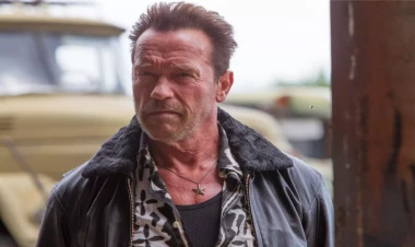 Şvartsenegger əməliyyatdan sonra yeni FOTOsunu paylaşdı