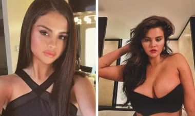Kökəldiyi üçün tənqid olunan Selena Qomez hər kəsi kədərləndirdi - FOTO