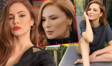 Minənin estetik peşmanlığı - Dolğu dondu...