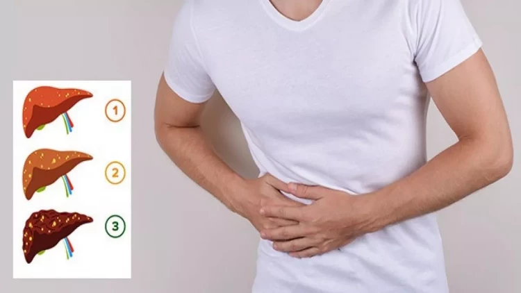 Qaraciyəri piylənmədən necə xilas edək?