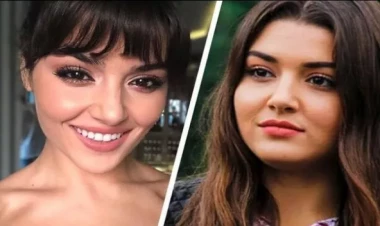 Məşhurların arxiv görüntüləri “Estetik etdirməmişəm” iddialarını yalanladı - FOTOlar