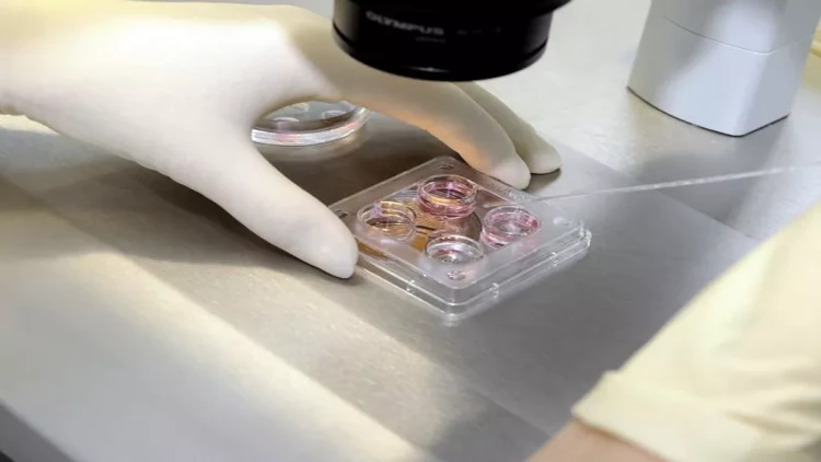 İİV-ə yoluxanların sayı açıqlandı