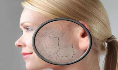 Dərinizdəki 10 əlamət XƏSTƏLİKDƏN XƏBƏR VERİR