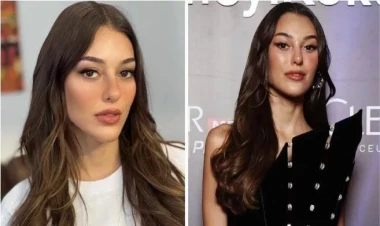 Tanınmış aktrisa plastik əməliyyat qurbanı oldu - FOTOlar