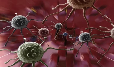 2024-cü ildə xərçəng xəstəliyi kəskin artacaq - XƏBƏRDARLIQ