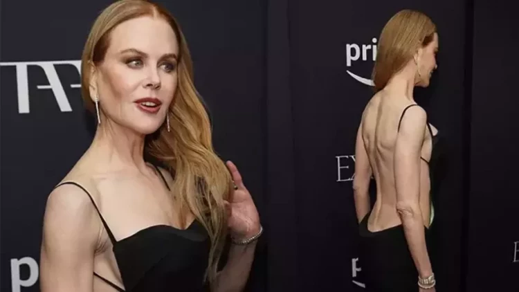 56 yaşlı Nikol Kidman açıq libası ilə heyran etdi - FOTOlar